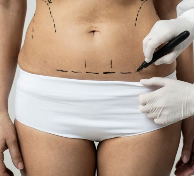 lipo enzimatica dra samara berbert dermatologista